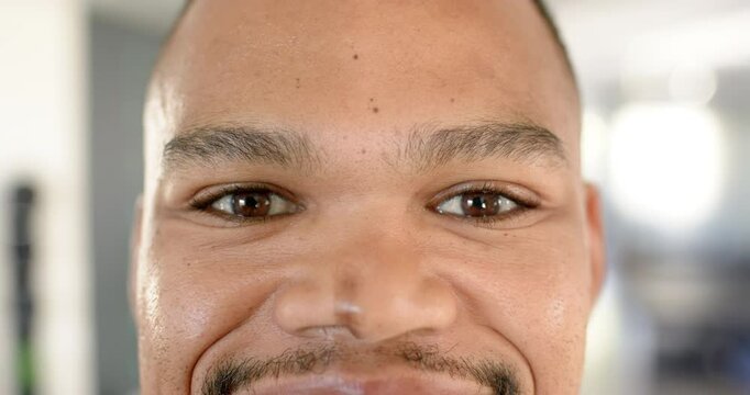 Smiling man with facial scars looking directly at camera, close-up portrait