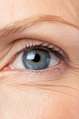 Eyes close-up showcasing crow feet in a natural smile