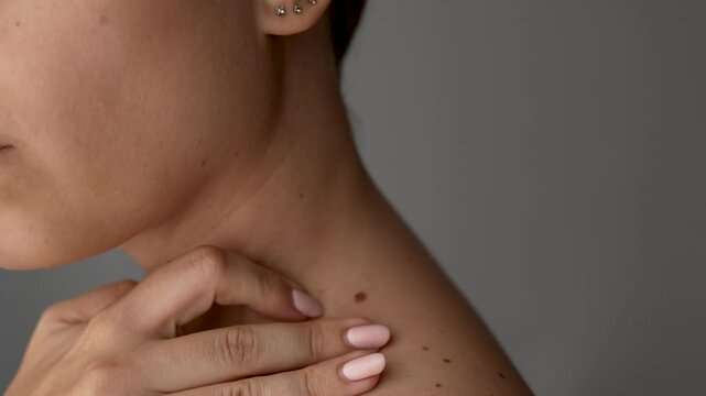 Young caucasian woman showing a big mole on her neck with her hand on a dark grey background. The effect of sunlight on the skin
