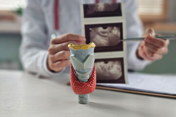 The doctor holds the results of a thyroid ultrasound examination. Thyroid diseases, nodular goiter