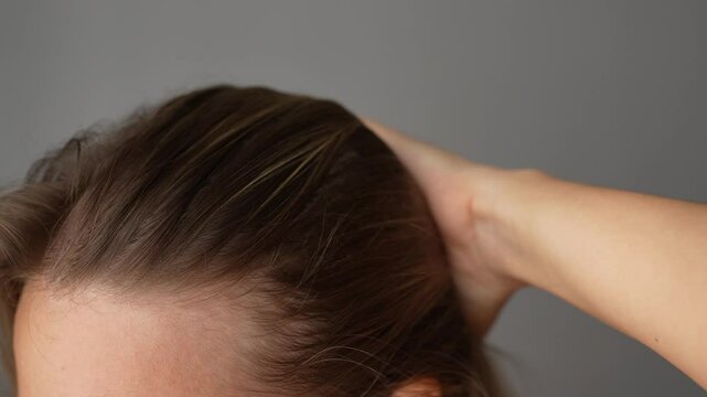 Young blonde woman showing receding hairline on her forehead and temples pushing hair back with her hand. Hair care. A girl demonstrating a healthy scalp and the absence of dandruff on grey background
