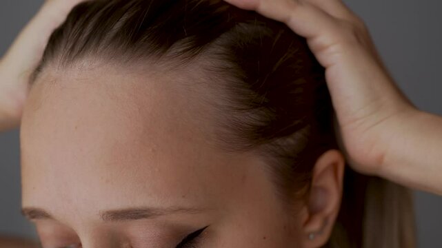 Young caucasian blonde woman showing receding hairline on her forehead and temples pushing hair back with her hand. Hair care. A girl demonstrating a healthy scalp and the absence of dandruff