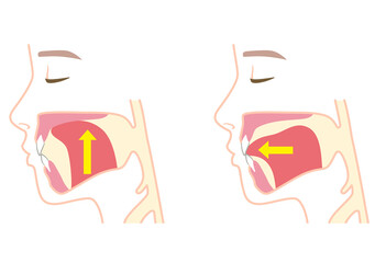 正しい舌の位置と下がっている舌の位置　ミューイング © koti