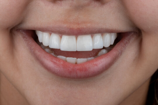 Mujer de sonrisa hermosa y sexys labios de dientes blancos 