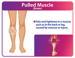 Understanding Muscle Strain and Recovery