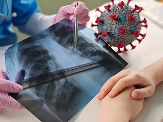 Doctor examining X-ray while holding a model of the COVID hmpv virus