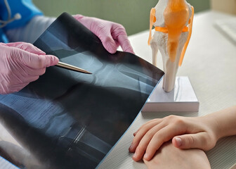 Doctor shows anatomy of knee joint and x-ray concept