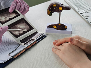 Ultrasound diagnosis of stomach and liver on abdominal cavity of in clinic.