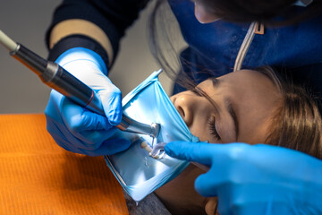 The dentist treats the child's tooth using a rubber dam. Close-up of tooth treatment.