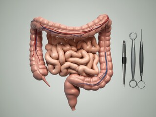 Human large intestine anatomical model with surgical tools