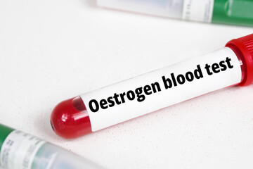 Oestrogen blood test title text of medical analysis