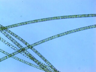 Algae in freshwater, microscopic image