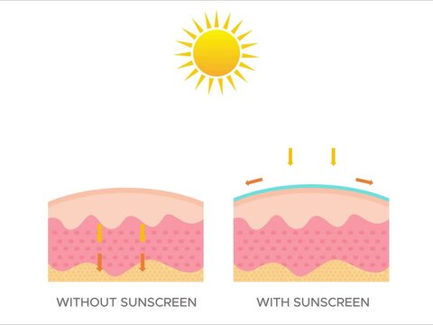 Comparison of skin using sunscreen with normal skin. Protection of the skin from ultraviolet radiation
