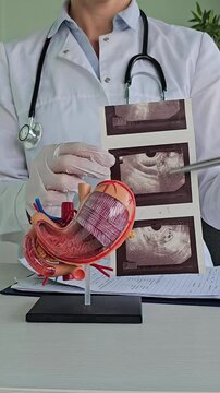 Doctor examines stomach model and ultrasound image. Stomach ulcers, intestinal cysts and oncology 