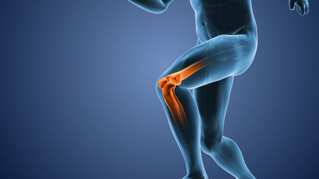 Medical figure with knee bone highlighted