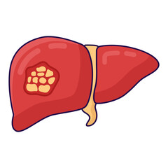 lung disease