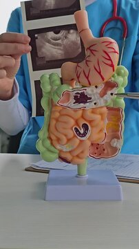 Doctor examines digestive system model and ultrasound image. Stomach intestine ulcers cyst and oncology