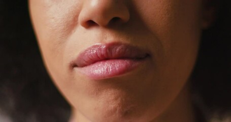 Hispanic woman smiles showing braces on teeth closeup