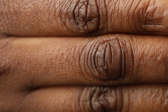 Macro view of normal skin as background