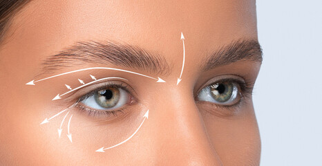 Rejuvenation of sagging and wrinkled skin around the eyes. Rejuvenating anti wrinkle injections on...