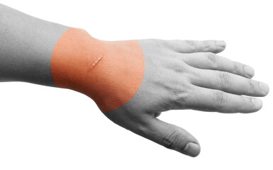 Large scar on human body close-up. Skin scar removal.