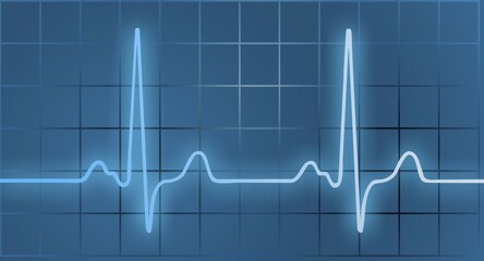 ECG, symbolic picture, Germany, Europe