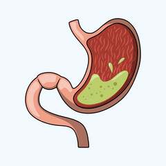 Healthy Human Stomach with Gastric Acid