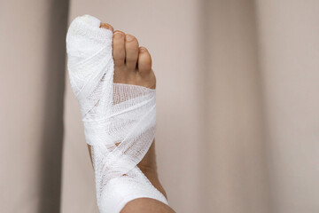 Fracture of the big toe. Bandaged foot with white bandage on a beige background. Medical concept....
