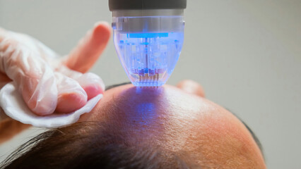 Procedure needle fractional RF for face lifting in a beauty clinic