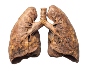 Isolated human lungs with detailed structure, showcasing intricate bronchial tree and alveoli. This anatomical representation highlights importance of respiratory health