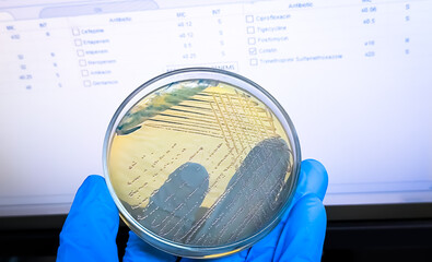 Serratia marcescens colony in petri dish,  is a species of rod-shaped, Gram negative bacteria in...