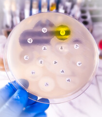 Antimicrobial susceptibility testing in petri dish. Antibiotic resistance test of bacteria.