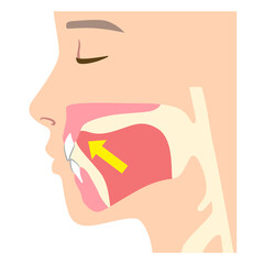 誤った舌の位置　ミューイング © koti