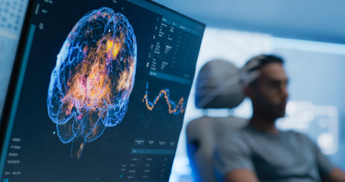 Medical Brain Scan on Computer Screen. Advanced Neuroimaging Technology Reveals Complex Neural Pathways. Patient Connected to Advanced Brain Scan in the Background