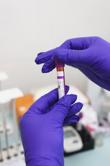 A tube with blood is placed in a tray for blood tests.