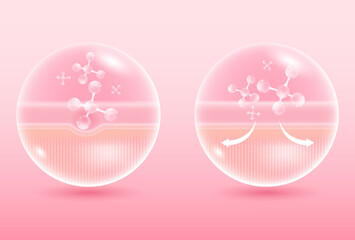 Vector illustration of healthy and damaged skin. Enhancers of epidermis and dermis skin layers. Caring for skin rejuvenation.