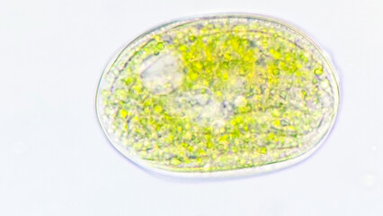Pseudomicrothorax sp., a freshwater cilliate collected from the pond. Stacked photo