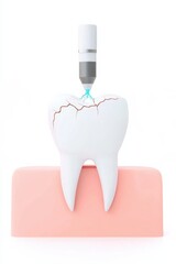 Dental technology with a cracked tooth and treatment tool.