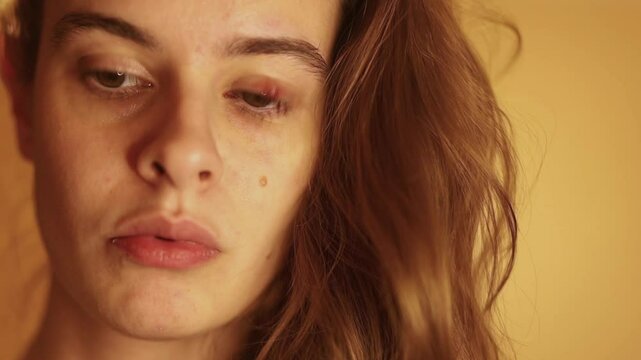 Close up of woman's face. Brown eyed woman looking at camera has external bacterial infection of stye or chalazion. Treatment, laser vision correction, ophthalmology services advertising concept.