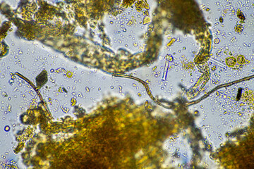 soil fungi on a farm soil microbes under the microscope. microorganisms with fungus in compost
