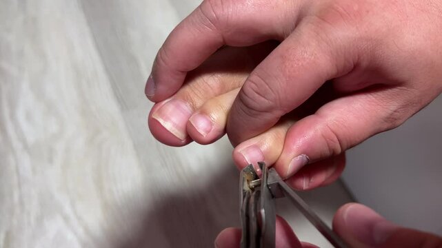 Horizontal 4K video close up. Man cuts toenails on female leg with nail biter in hotel bed room. Wood floor. Toe. Hygiene, self care, body positive, cosmetic procedure, spa. Nail clipper. Male hand 