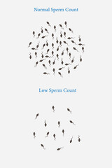 normal and low sperm count illustration. Male infertility oligospermia. Structure of the sperm. Vector. eps 10. medical illustration