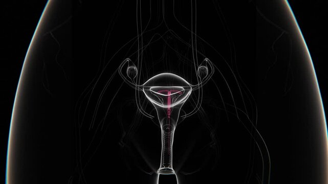 Intrauterine Device (IUD) Indication X-ray in HD video | IUD Birth Control device in female X-ray video in HD Format