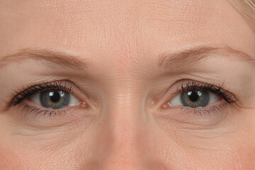 Close-up view of skin texture around the eyes
