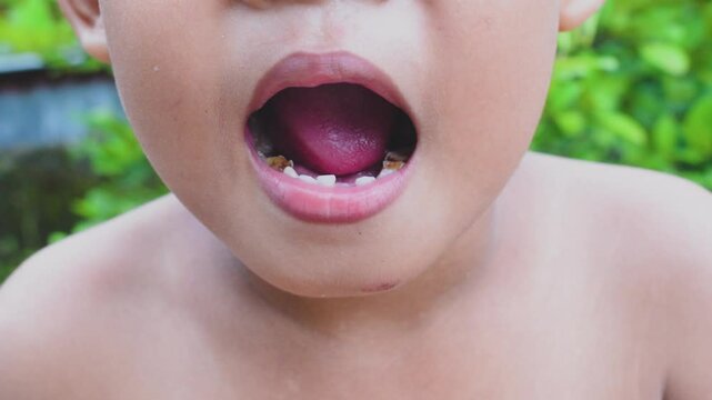 Close-up of the mouth of a child who has lost his baby teeth. Replacement of permanent teeth, missing teeth and cavities in children. dentistry concept.