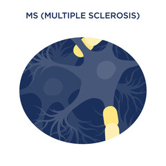 Vector Oval MS - Multiple Sclerosis Icon