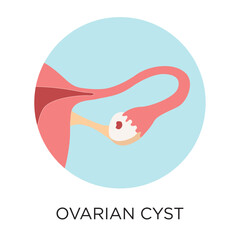 Vector Ovarian Cyst Icon