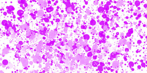  abnormal hematological blood cell. Bone marrow study.USG guided FNA cytology of liver SOL showing Non Hodgkin lymphoma.