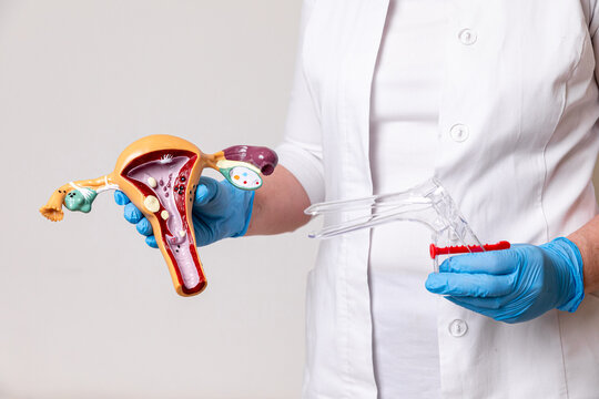 Doctor or nurse holding Uterus and Ovaries model with pathology and gynecological speculum. Ovarian and Cervical cancer, Cervix disorder, Endometriosis, Hysterectomy, Uterine fibroids