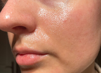 Close-Up of Young Woman’s Face with Organic Oil Application for Hydrating and Nourishing Skin –...
